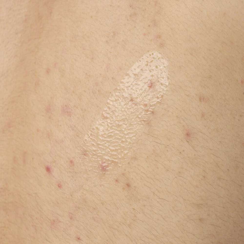 Salicylic Acid 0.5% Body Serum_769915233520_The Ordinary-3