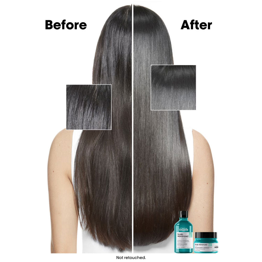 Scalp Advanced Shampoo Anti-Oiliness_3474637106430_L'Oréal Professionnel-2