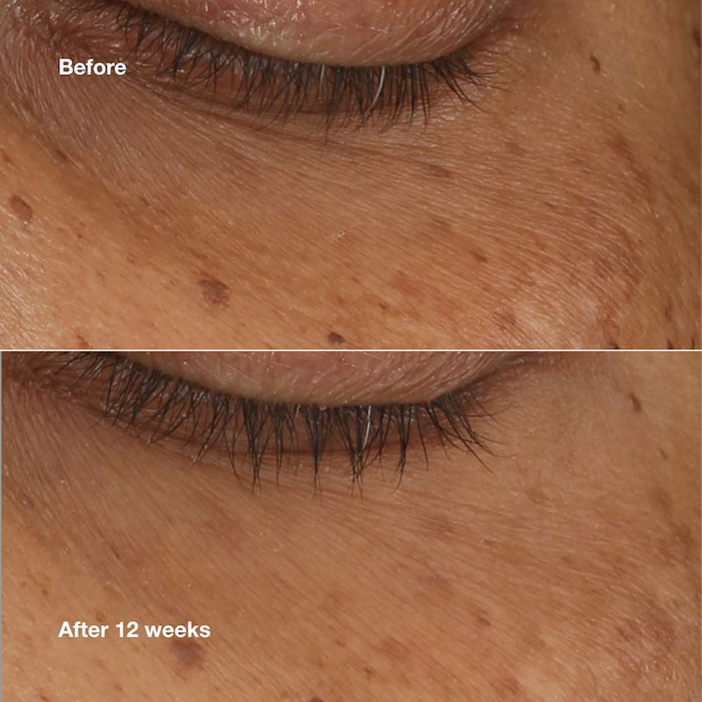 All About Eyes Brightening Serum Concentrate_192333237007_Clinique-2