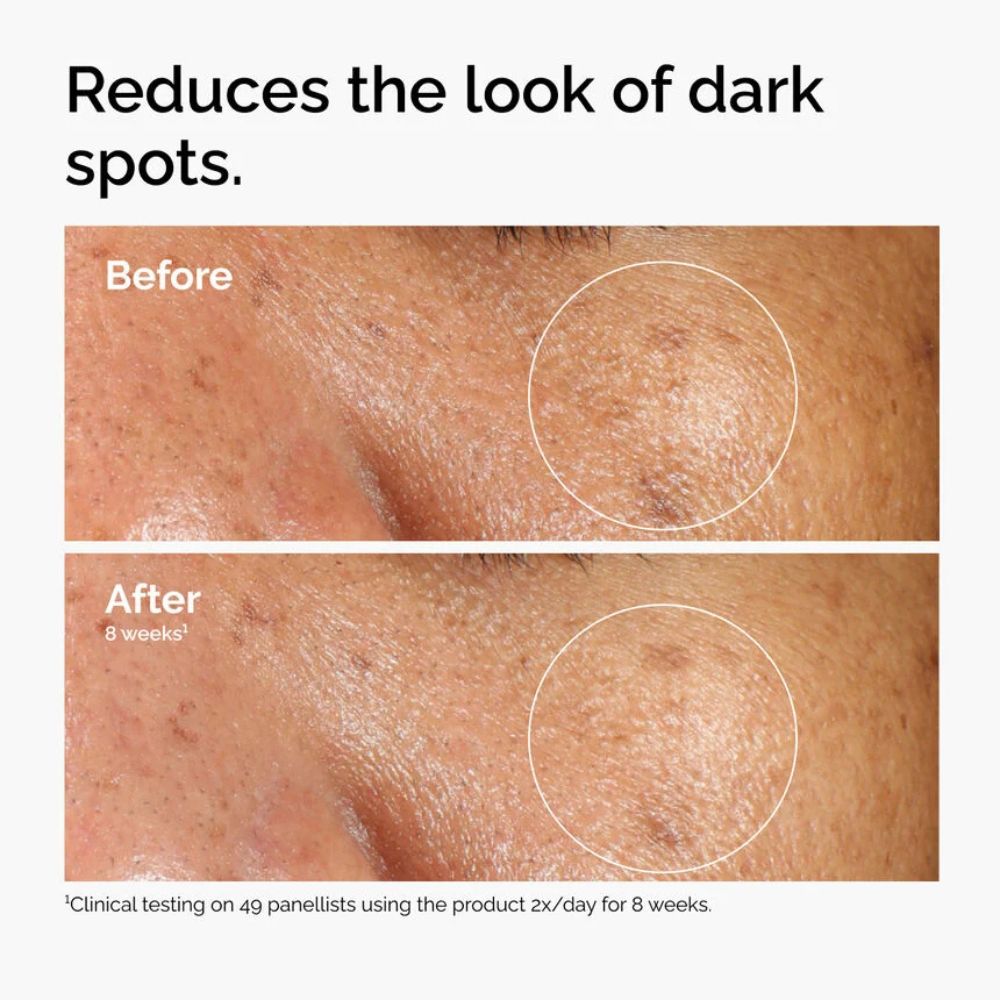 Alpha Arbutin 2% + HA_769915233674_The Ordinary-5