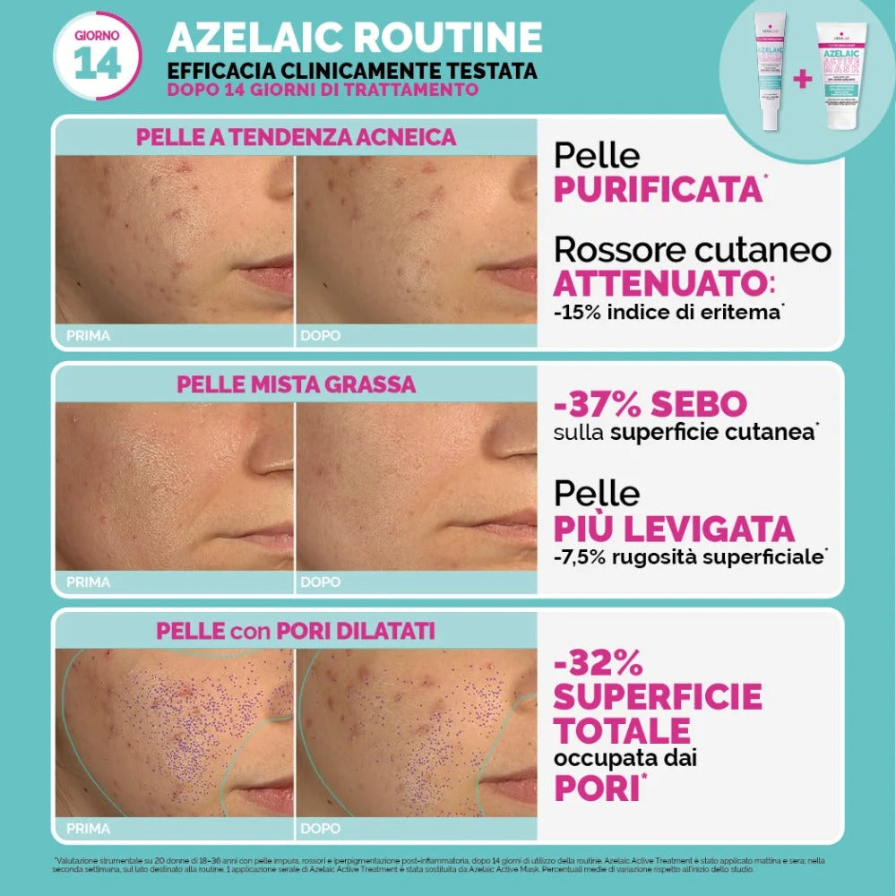 Azelaic Active Mask_8056151303714_Veralab-7