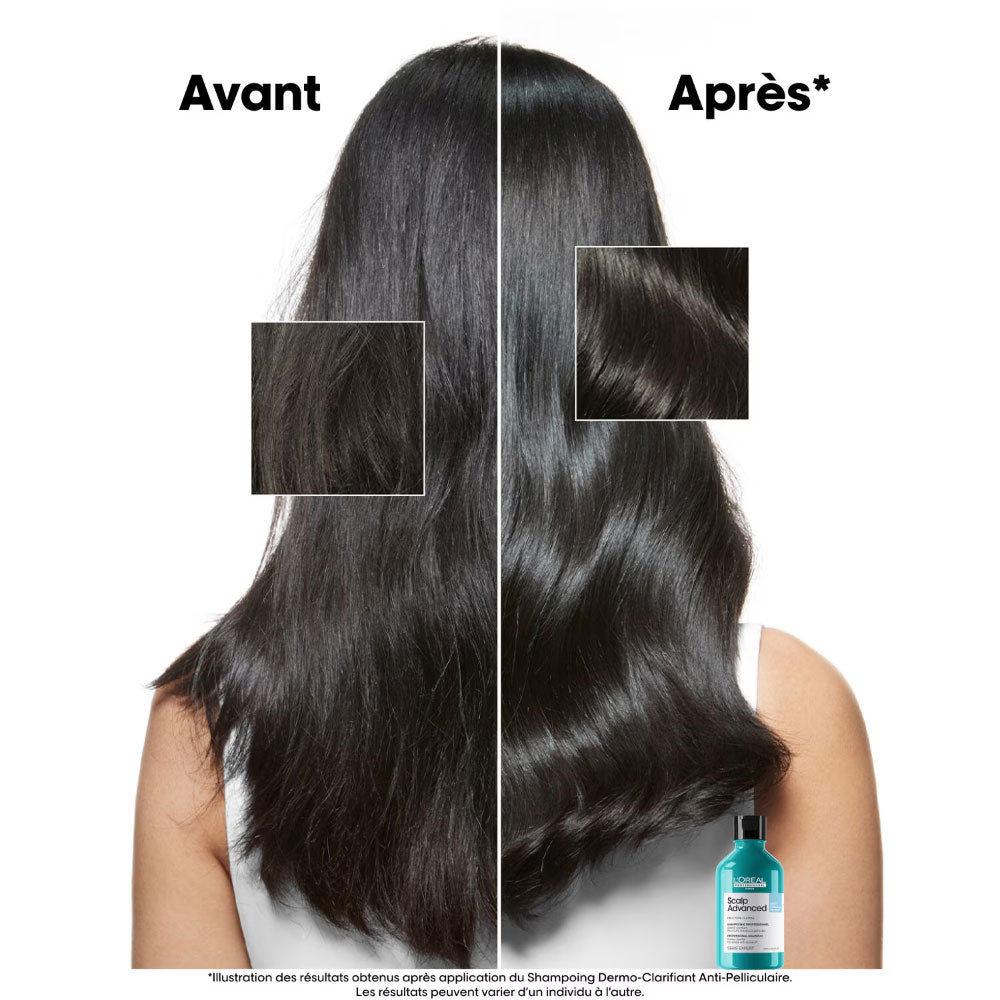 Scalp Advanced Shampoo Anti-Dandruff_3474637109394_L'Oréal Professionnel-3