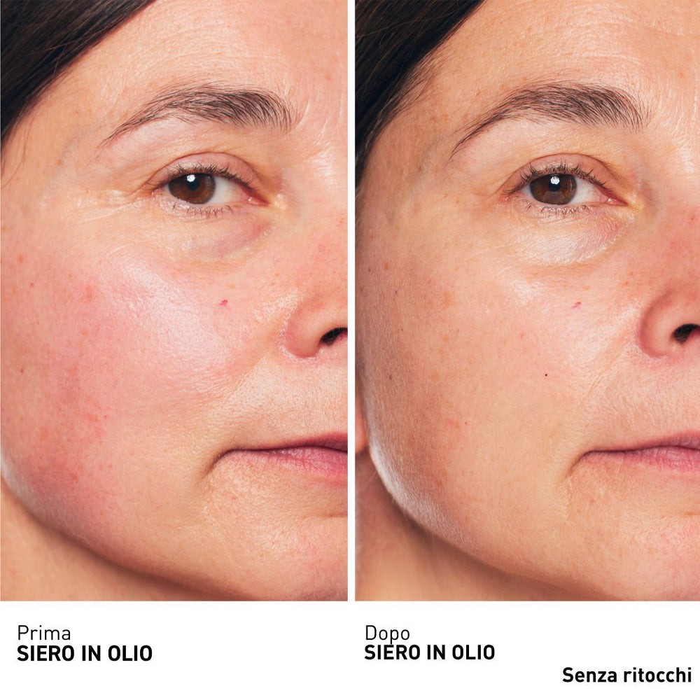 Skin Therapy_8809255787832_Erborian-3