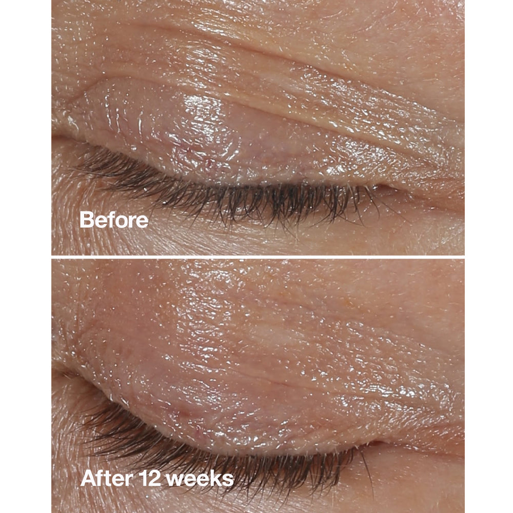 Smart Clinical Repair Eye Cream_192333164525_Clinique-3