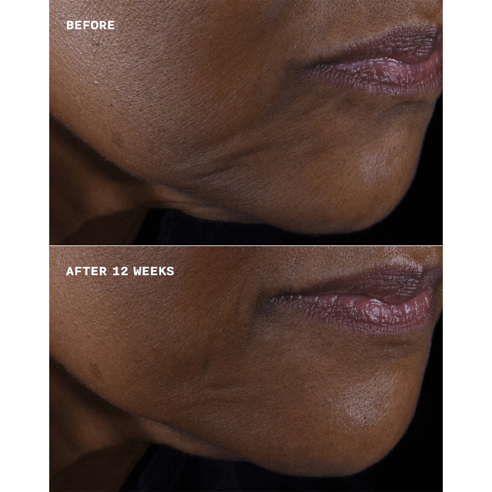 Smart Clinical Repair Lifting Face + Neck Cream_192333144756_Clinique-3